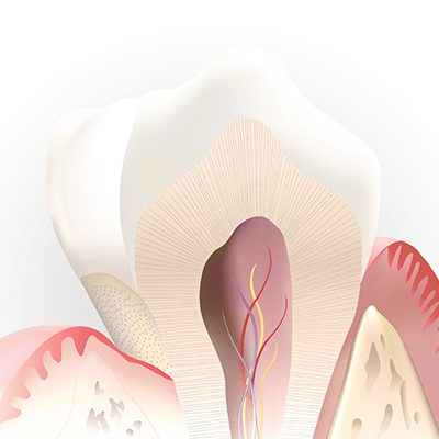Animated tooth in need of pulp therapy