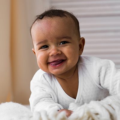 Laughing baby after frenectomy for lip and tongue tie