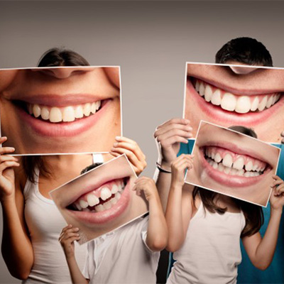 Man with veneers in Rancho Bernardo smiling in dentist’s office