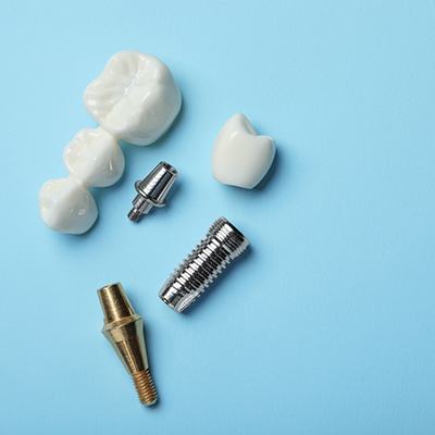 Dental implant and dental bridge parts set against a blue background