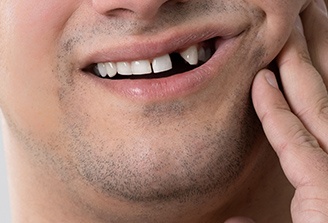 Closeup of patient with knocked out tooth