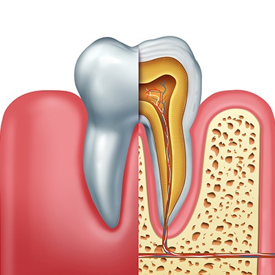 Animated tooth in need of root canal therapy