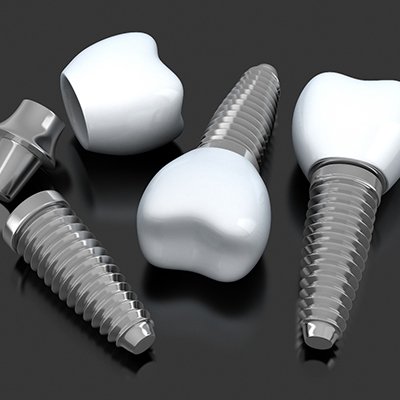 three dental implants with abutments and crowns 