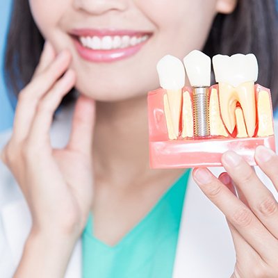Dentist holding dental implants in Rancho Bernardo 