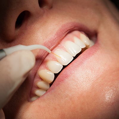 Patient receiving laser dentistry treatment