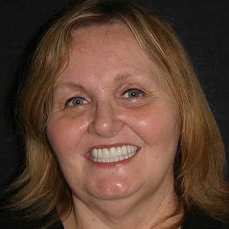 Woman smiling after gum disease treatment in Rancho Bernardo