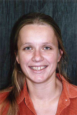 Young woman with crooked yellow teeth
