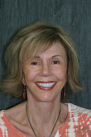 Older woman with a perfect white smile after transformation