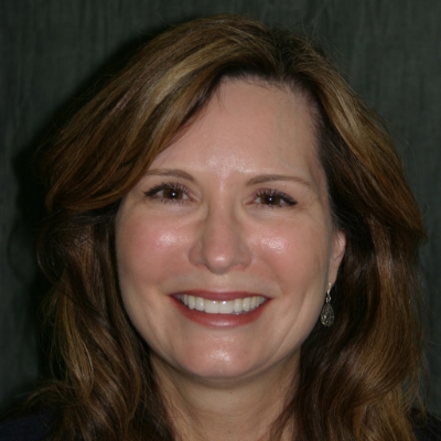 Model of the smile with a dental crown restoration