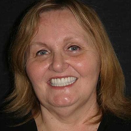 Woman smiling after sedation dentistry in Rancho Bernardo