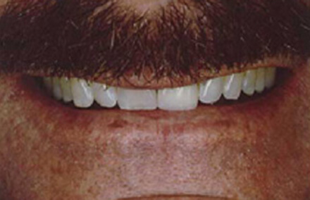 Dentist's smile before transformation