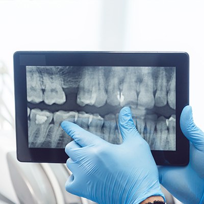 Dentist pointing to digital x rays of teeth on tablet screen