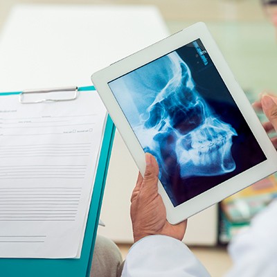 X-ray of jaw and skull bone used for T M J therapy treatment