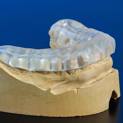 Model smile with occlusal splint in place
