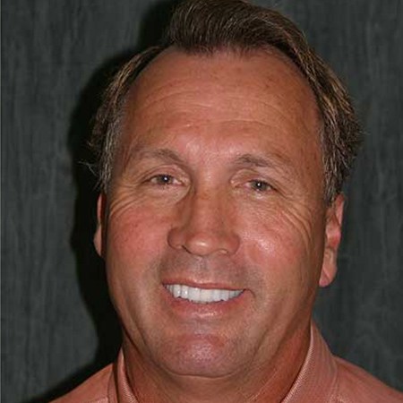 Older man smiling after T M J treatment in Rancho Bernardo