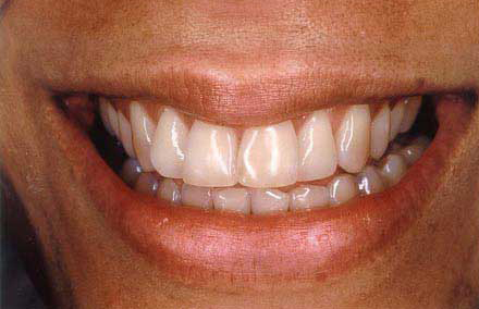 Lovely smile with some dental discoloration