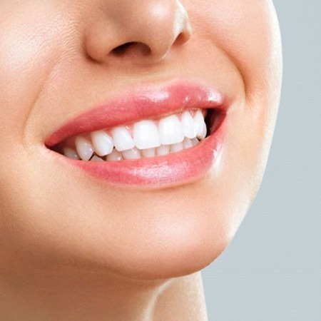 Close up of bright smile after teeth whitening in Rancho Bernardo