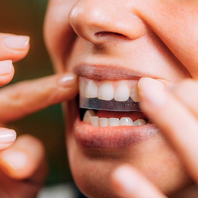 Woman using teeth whitening strips