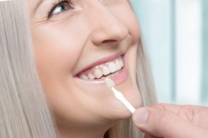 woman smiling with veneers  