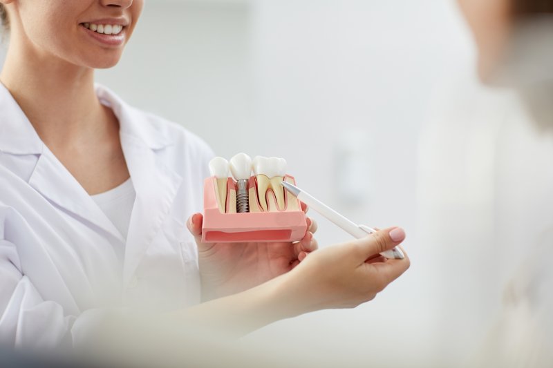 female dentist smiling and holding dental implant in Rancho Bernardo