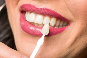 Woman getting porcelain veneers