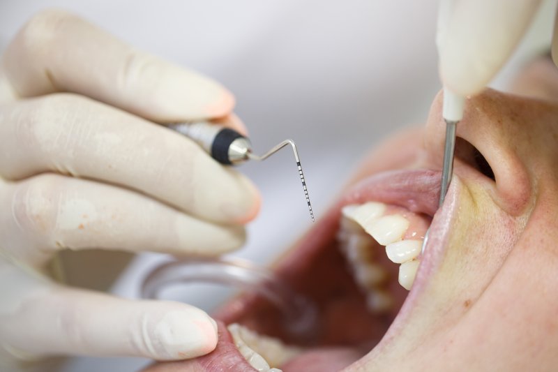 gum disease therapy