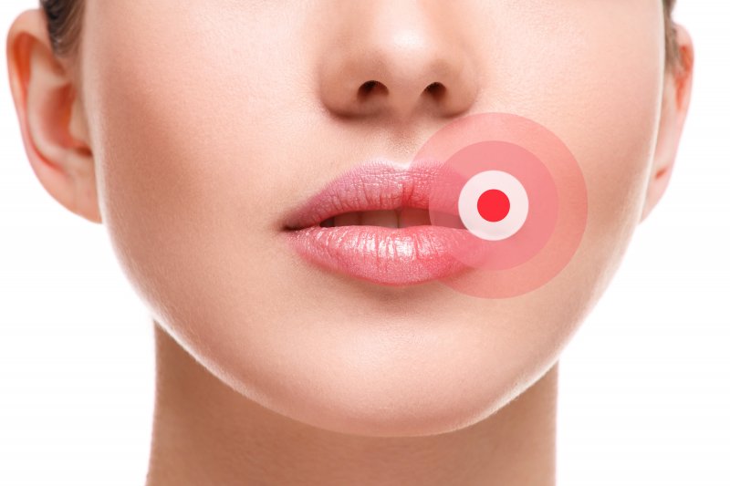 Woman with a red target on her lips