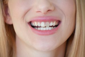 a woman smiling with a gray front tooth