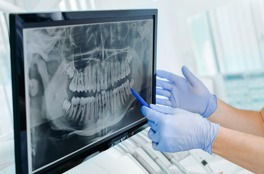 Dental x-ray